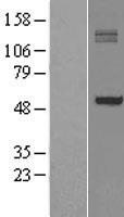 P4HA1 Human Over-expression Lysate