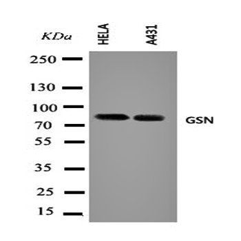 Anti-Gelsolin/GSN Antibody
