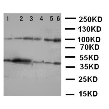 Anti-NFkB/NFKB1 p105/p50 Antibody