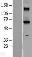 GUCY1B1 Human Over-expression Lysate
