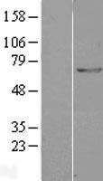 GAD67 (GAD1) Human Over-expression Lysate