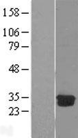 DCK Human Over-expression Lysate
