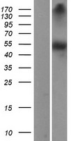 DOPA Decarboxylase (DDC) Human Over-expression Lysate