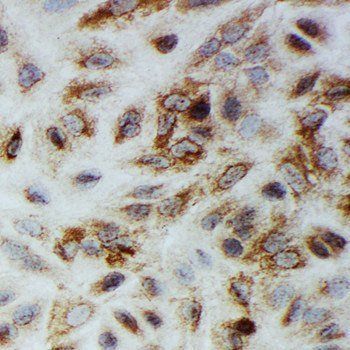 Anti-Smad1 Antibody