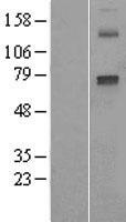 Cytochrome P450 2E1 (CYP2E1) Human Over-expression Lysate