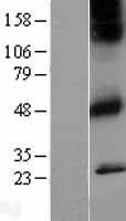 CHRM1 Human Over-expression Lysate