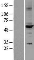 Cytochrome P450 2C9 (CYP2C9) Human Over-expression Lysate