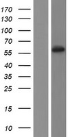 Cytochrome p450 2C19 (CYP2C19) Human Over-expression Lysate