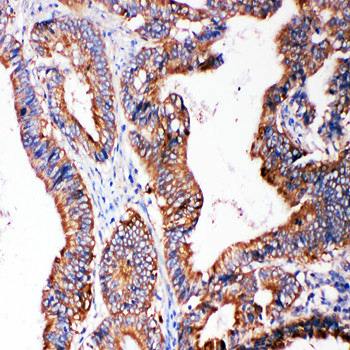 Anti-SMAD5 Antibody