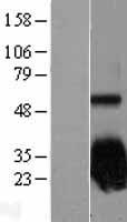 SOD2 Human Over-expression Lysate