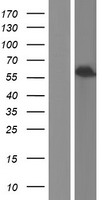 ALDH1A3 Human Over-expression Lysate