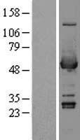 ALDH3A1 Human Over-expression Lysate