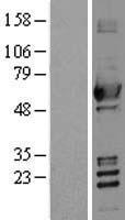 ALDH2 Human Over-expression Lysate