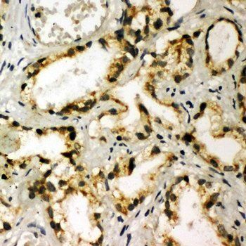 Anti-NAK/TBK1 Antibody
