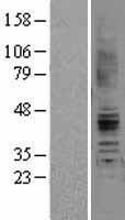 Angiotensin II Type 2 Receptor (AGTR2) Human Over-expression Lysate