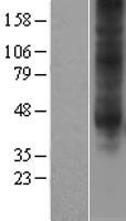 Adenosine A3 Receptor (ADORA3) Human Over-expression Lysate