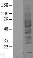 Adenosine A2b Receptor (ADORA2B) Human Over-expression Lysate