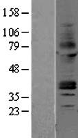 Adenosine Receptor A2a (ADORA2A) Human Over-expression Lysate