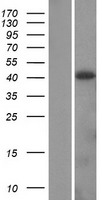 ADH4 Human Over-expression Lysate