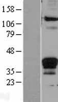 Fas Ligand (FASLG) Human Over-expression Lysate