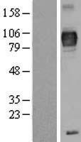 TRP1 (TYRP1) Human Over-expression Lysate