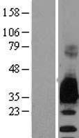 Myelin Protein Zero (MPZ) Human Over-expression Lysate