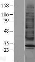 MC2 receptor (MC2R) Human Over-expression Lysate