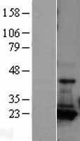 Adenylate Kinase 1 (AK1) Human Over-expression Lysate