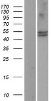 CYP11B1 Human Over-expression Lysate