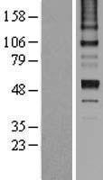 Antithrombin III (SERPINC1) Human Over-expression Lysate