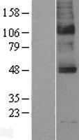 Sodium Iodide Symporter (SLC5A5) Human Over-expression Lysate