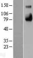CD62E (SELE) Human Over-expression Lysate
