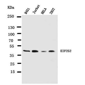EIF2S2 Antibody