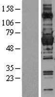 Glucose 6 Phosphate Dehydrogenase (G6PD) Human Over-expression Lysate
