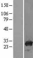 TPMT Human Over-expression Lysate