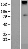 SGLT1 (SLC5A1) Human Over-expression Lysate