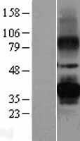 PRPH2 Human Over-expression Lysate