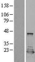 PTS Human Over-expression Lysate