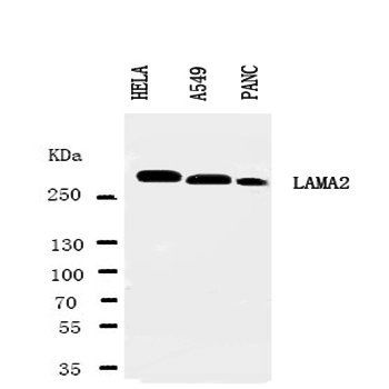 Anti-Laminin 2 alpha/LAMA2 Antibody