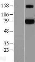 Protein S (PROS1) Human Over-expression Lysate