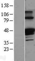 alpha 1 Antitrypsin (SERPINA1) Human Over-expression Lysate
