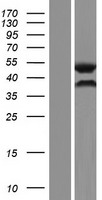 PAX6 Human Over-expression Lysate