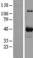 ornithine aminotransferase (OAT) Human Over-expression Lysate