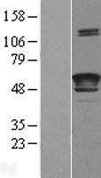 LCAT Human Over-expression Lysate