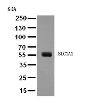 EAAT3/SLC1A1 Antibody