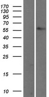 TBX5 Human Over-expression Lysate