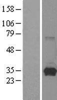 HPRT (HPRT1) Human Over-expression Lysate
