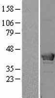 HMBS Human Over-expression Lysate