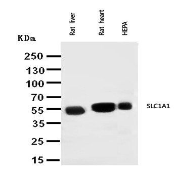 EAAT3/SLC1A1 Antibody