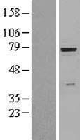 beta glucuronidase (GUSB) Human Over-expression Lysate